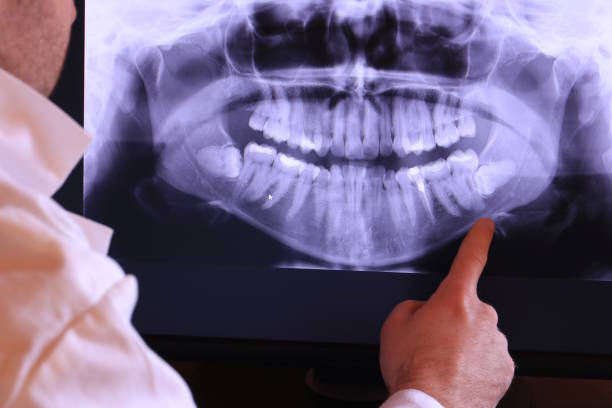 Best Emergency Tooth Extraction  in Fullerton, NE